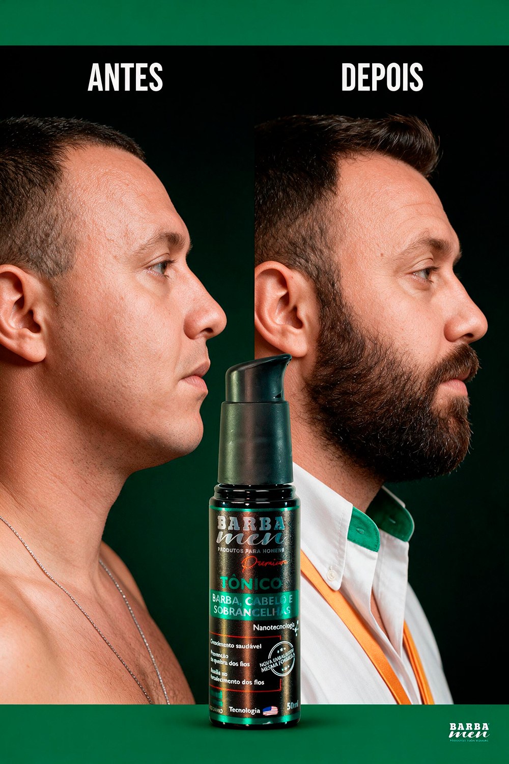 Comparativo Antes e Depois de preenchimento de barba com o Tônico For Men Barba Men 50ml