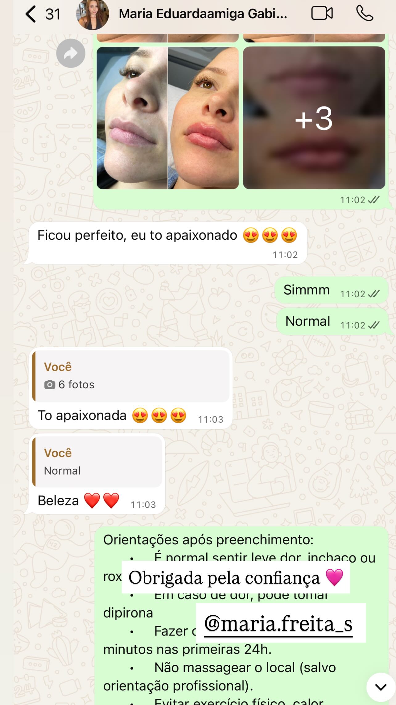 Depoimento de Cliente GynLaser