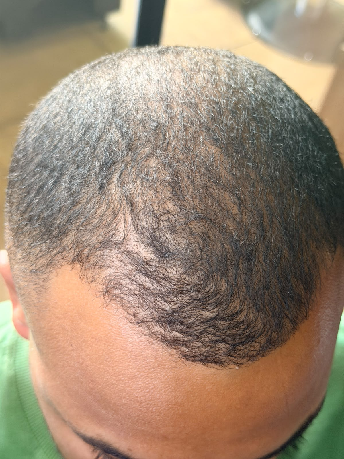 Antes: registro da parte frontal do cabelo
